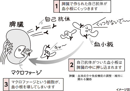 ITPが起こる仕組み