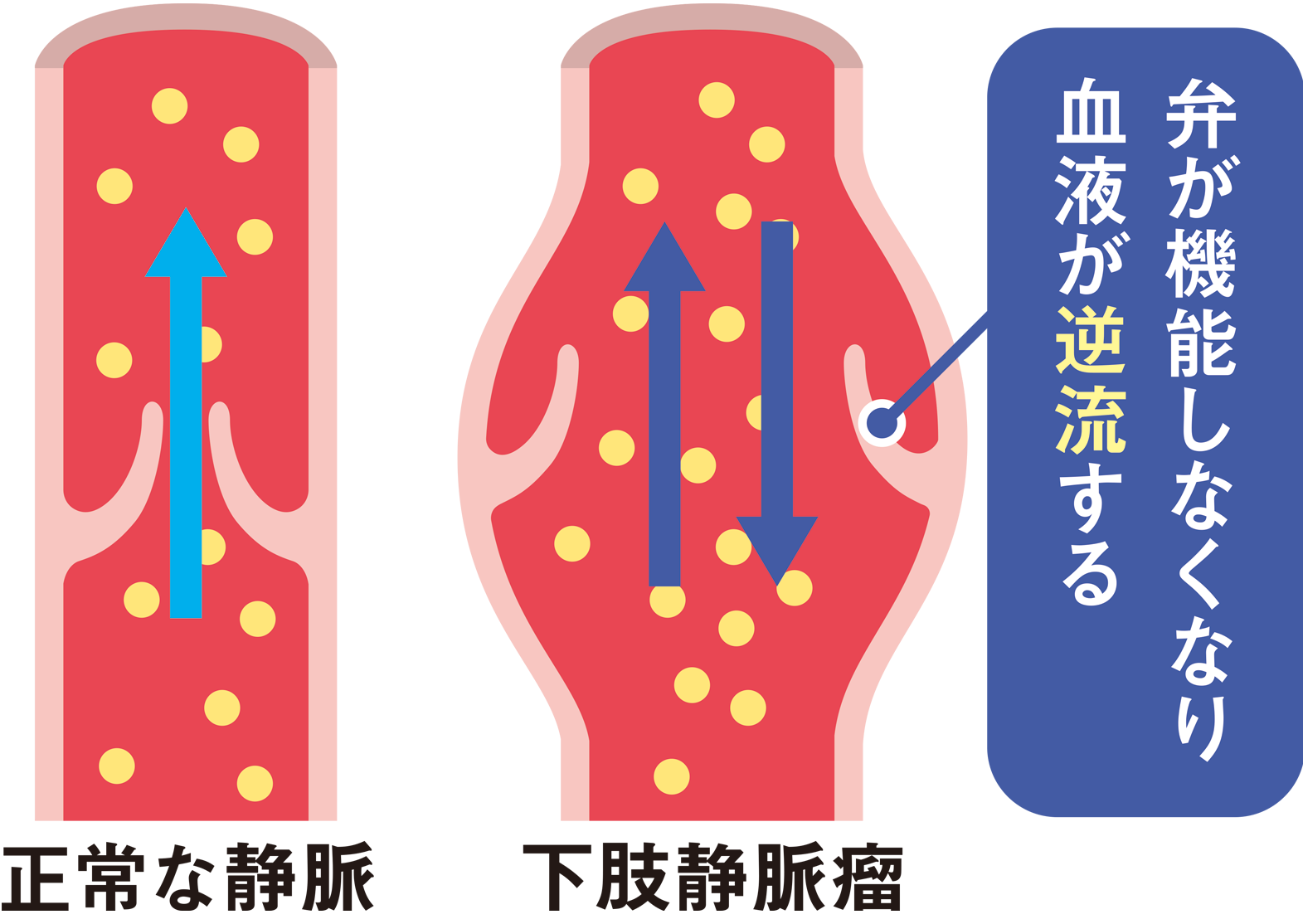 図２ 静脈の状態