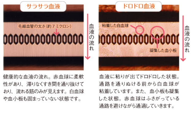 MC-FAN画像