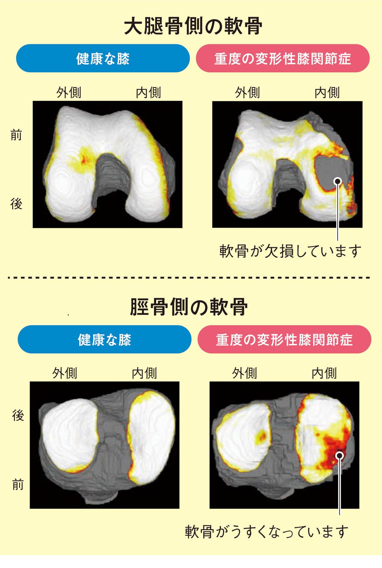 膝が痛い 解消するためのポイントを知ろう 健康情報 全薬工業株式会社